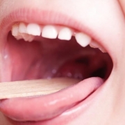 Streptococcus-pyogenes-800×445